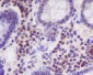 Anti-p27 KIP 1 CDKN1B Rabbit Monoclonal Antibody